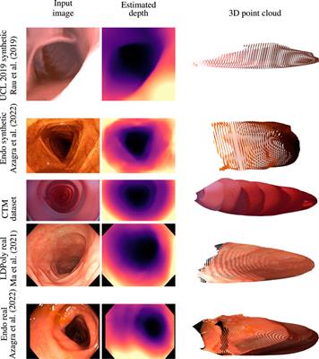 Self-supervised monocular depth estimation for high field of view colonoscopy cameras